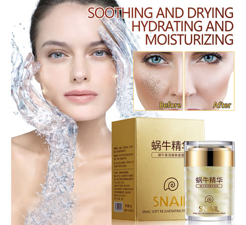Hd Crema Hidratante U Snail Que Hidrata La Piel Seca Y Suave