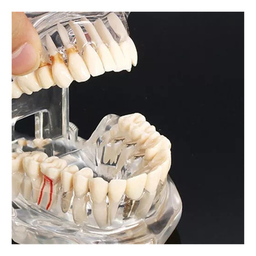Manequim Ortodontista Macro Dental Modelo Odonto Orto