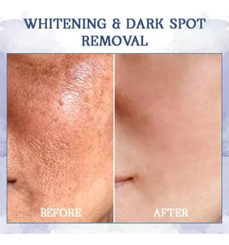 Fubsta Tig Advanced Creme Reafirmante E Redutor De Rugas