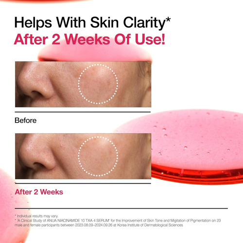 Anua 10% Niacinamide+ 4% Serum Quita Manchas Acne Sin Fragan Mixta Día/noche