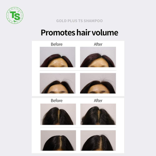 Champú Gold Plus Ts Para Crecimiento Y Grosor Del Cabello, 5