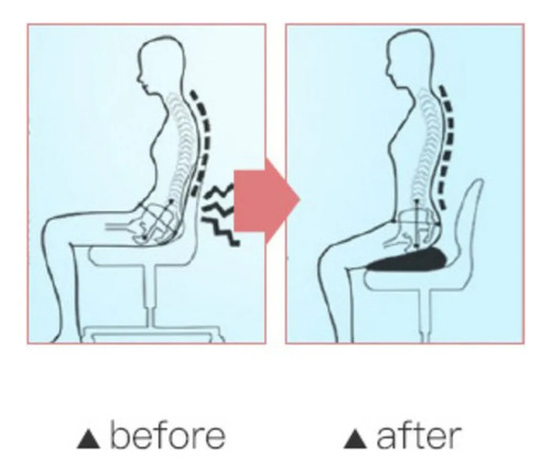 Cojín De Asiento De Espuma Viscoelástica Para Hemorroides,