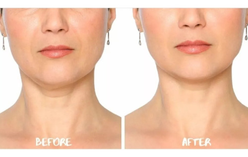 Mascarilla Tensora Reductora De Papada Y Contorno Facial