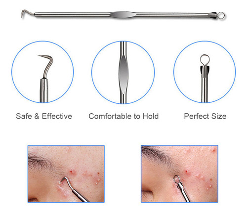 A Kit 4 En 1 Acne & Blackhead R For El Cuidado De La Piel