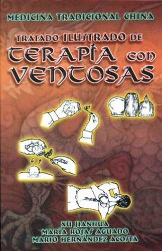 Terapia Con Ventosas