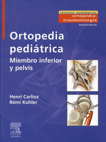 Ortopedia Pediátrica. Miembro Inferior Y Pelvis