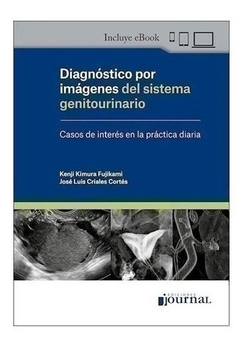 Diagnóstico Por Imágenes Del Sistema Genitourinario - Kimur