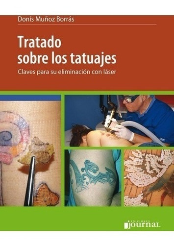 Muñoz Borras Tratado Sobre Tatuajes Eliminación Laser Envíos