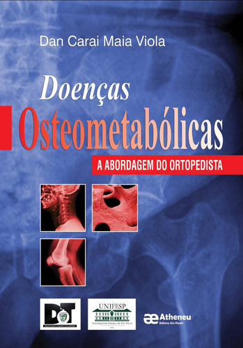 Doenças osteometabólicas, de Viola, Dan Carai Maia. Editora Atheneu Ltda, capa mole em português, 2015