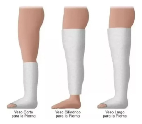 Vendas De Yeso 20cms X 3 Mt Yesoterapia Lesiones Listas