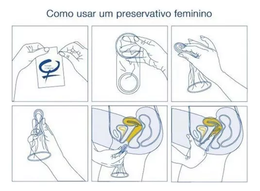 Segunda imagem para pesquisa de camisinha feminina