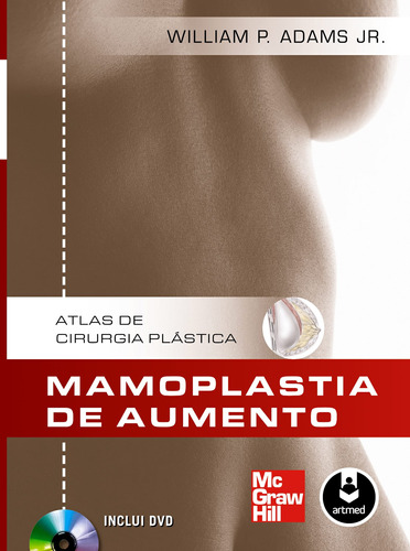 Mamoplastia de Aumento: Atlas de Cirurgia Plástica, de Adams Jr, William P.. Editora AMGH EDITORA LTDA.,McGraw-Hill Companies, Inc., capa dura em português, 2013