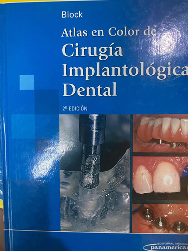 Atlas De Cirugía Implantologica Dental 2 Ed Bloco
