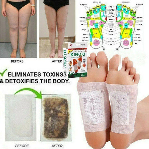 100 Parches Kinoki Desintoxicantes Para Pies Cuerpo