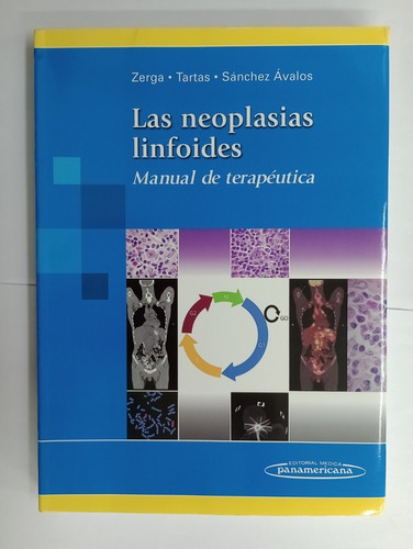 Las Neoplasias Linfoides - Zerga - Tartas - Sanchez Ávalos