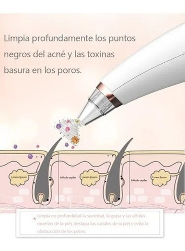 Extractor Removedor Puntos Negros Set Máquina Extractores