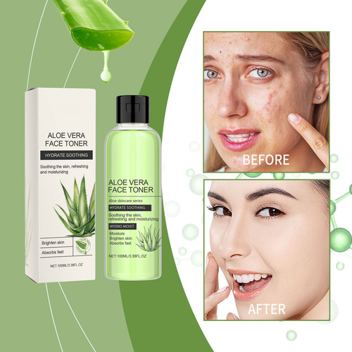 ! Loción Calmante U Aloe Vera Que Calma Y Repone La Humedad