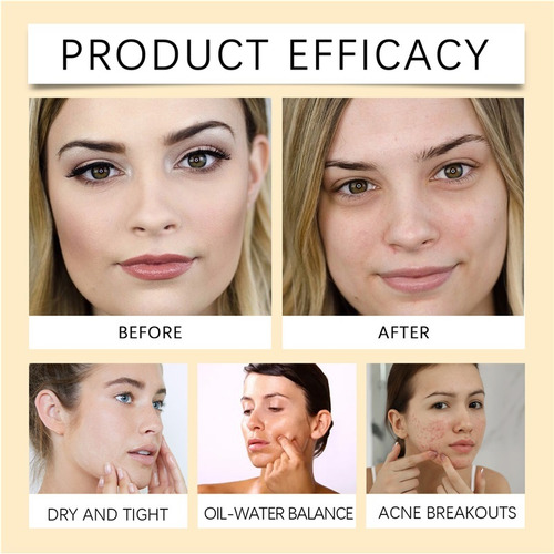 Jq Desmaquillante Refrescante Y Suave For Ojos Y Labios