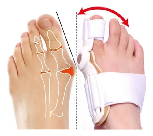 Férula Corrector De Juanetes Hallux Valgus Ortesis