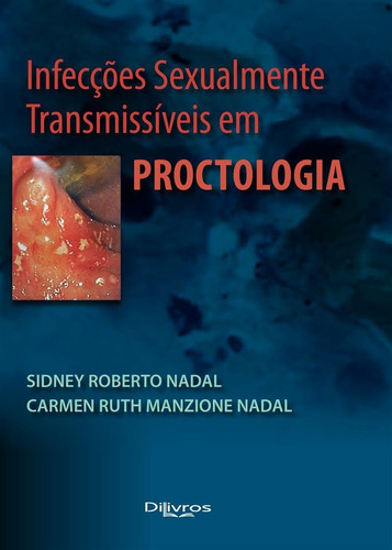 Livro: Infeccoes Sexualmente Transmissiveis Em Proctologia
