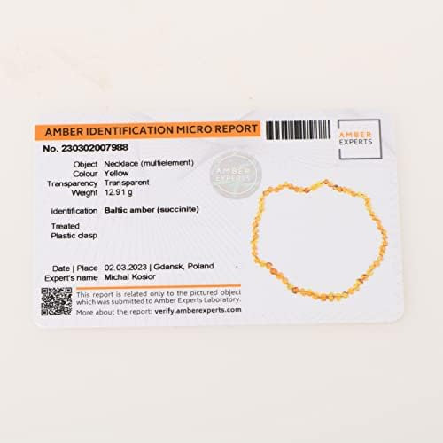 Pulsera De Ámbar Báltico En Banda Elástica - Pulsera De Cuen