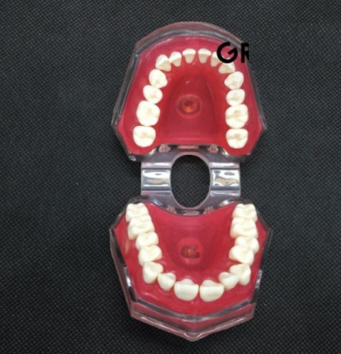 Imagen 7 de 10 de Modelo Acrílico Único Dientes Desmontables Encía Enseñanza