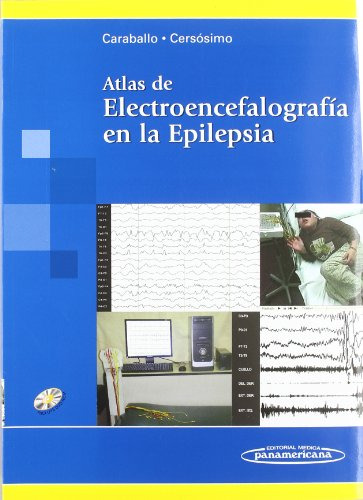 Libro Atlas De Electroencefalografia En La Epilepsia (incluy