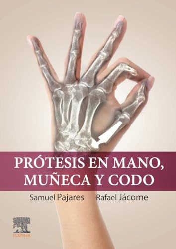 Protesis En Mano Muneca Y Codo - Pajares Samuel Jacome Rafae