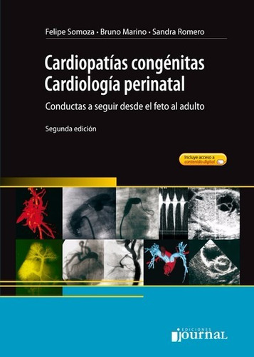 Somoza Cardiopatías Congénitas 2ed/2016 Nuevo Envíos T/país