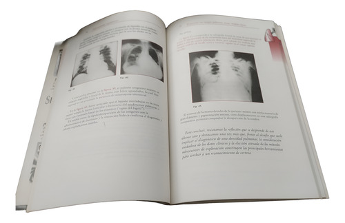Proami - Medicina Interna Fernando Lasala Ed . Panamericana (Usado)