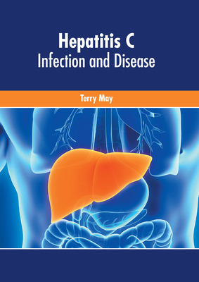 Libro Hepatitis C: Infection And Disease - May, Terry