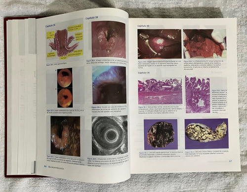 Libro Gastroenterologia Misael Uribe Esquivel (Usado)