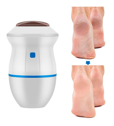 Imagen 5 de 10 de Lima Eléctrica Pedicure Vacuum Para Pies Removedor De Callos