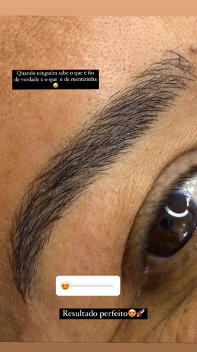 Imagem 4 de 5 de Micropigmentação E Estética