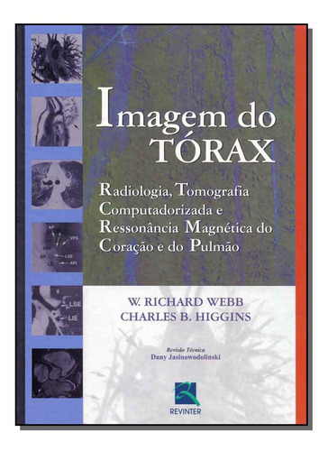 Libro Imagem Do Torax De Webb W Richard E Higgins Charles B