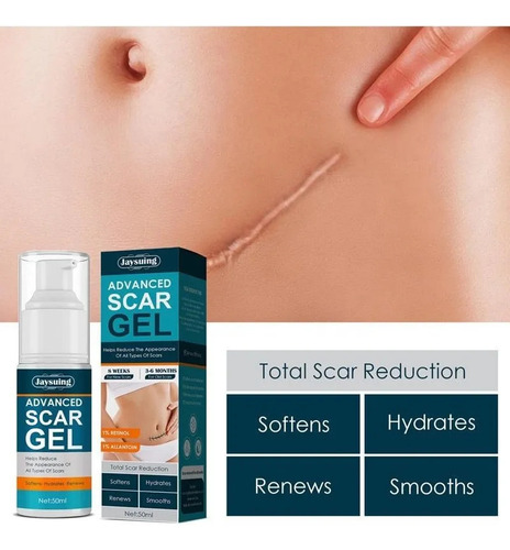 Gel De Creme De 2 Peças Para Remoção De Estrias E Cicatrizes