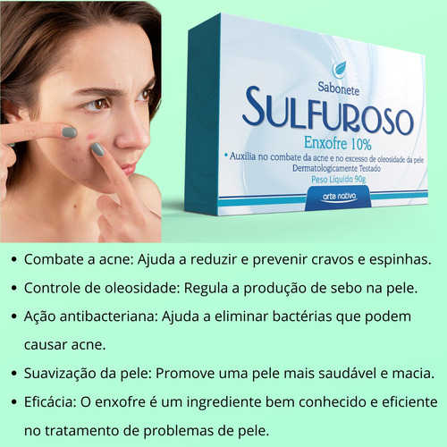 Sabonete Sulfuroso, Enxofre 10% Para Acne Cravos E Espinhas
