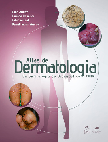 Atlas de Dermatologia - Da Semiologia ao Diagnóstico, de AZULAY-ABULAFIA, Luna. Editora Gen – Grupo Editorial Nacional Part S/A, capa mole em português, 2020