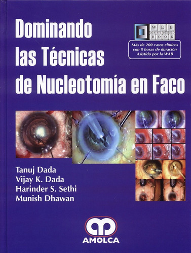 Dominando Las Tecnicas De Nucleotomia En Faco - Tanuj Dada