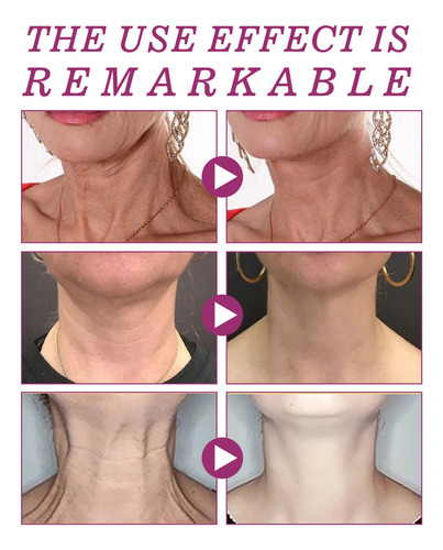 Crema De Cuello Para Levantar, Blanquear Y Reducir Las