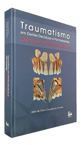 Traumatismo Em Dentes Deciduos E Permanentes