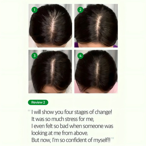 Some By Mi Cica Peptide Anti Hair Loss Derma Scalp Shampoo