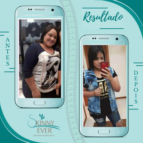 Imagem 6 de 10 de Skinny Ever Azul 20 Cápsulas