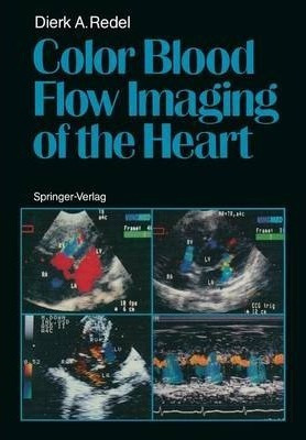 Color Blood Flow Imaging Of The Heart - Dierk A. Redel (p...