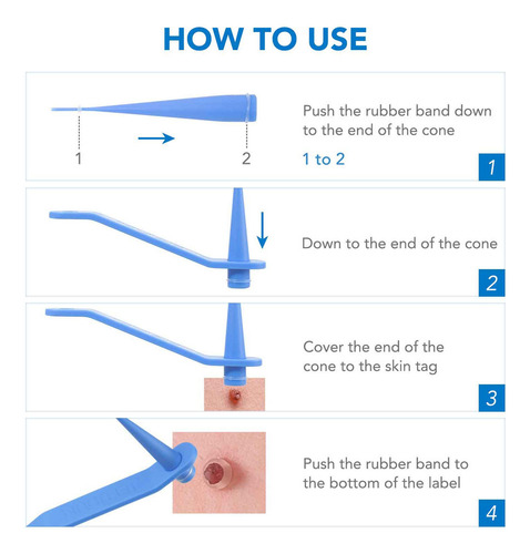 Micro Skin Tag Remover Kit De Eliminación De Etiquetas