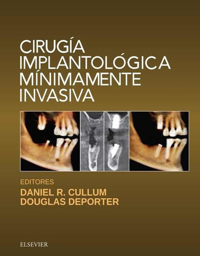 Cirugía Implantológica Mínimamente Invasiva, De Cullum. Editorial Elsevier, Tapa Dura En Español, 2018