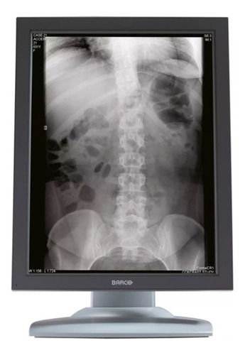 Monitor Barco Grado Medico 3mp