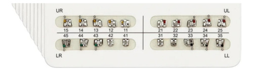 1 Kit Bracket Azdent Plus Ortodoncia Standard Roth Dentista