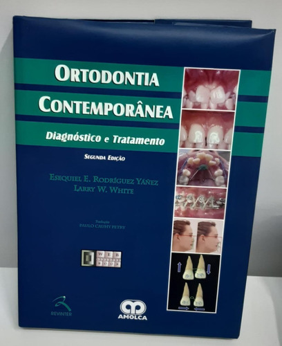 Ortodontia Contemporânea - Diagnóstico E Tratamento