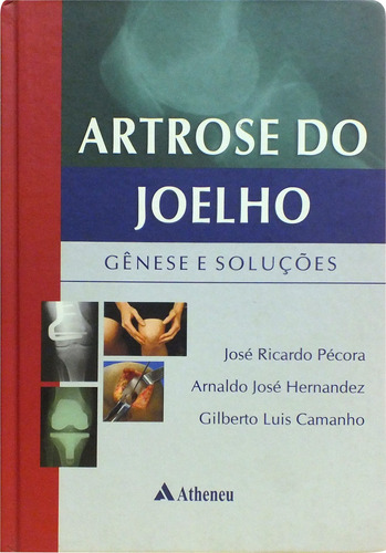 Artrose do joelho - gênese e soluções, de Hernandez, Arnaldo José. Editora Atheneu Ltda, capa mole em português, 2010